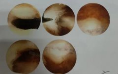 泰國試管嬰兒費(fèi)用需要多少？全面解讀泰國、美國、格魯吉亞的試管服務(wù)