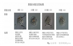 試管嬰兒胚胎級別大揭秘，優(yōu)質(zhì)胚胎如何養(yǎng)成？？？