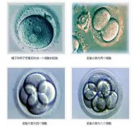 泰國曼谷醫(yī)院試管嬰兒機(jī)構(gòu)胚胎等級是如何劃定的？