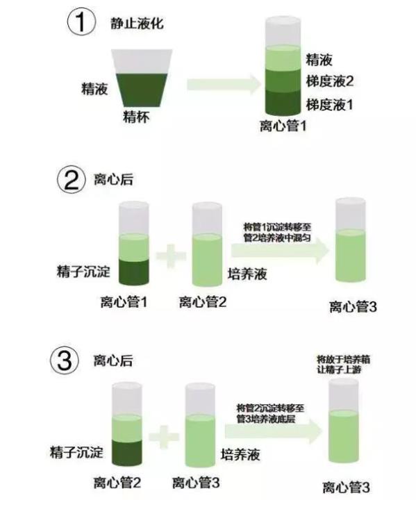HIV洗精術具體流程
