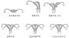 幼稚子宮可以懷孕生娃嗎?試管DY技術(shù)助力圓夢(mèng)