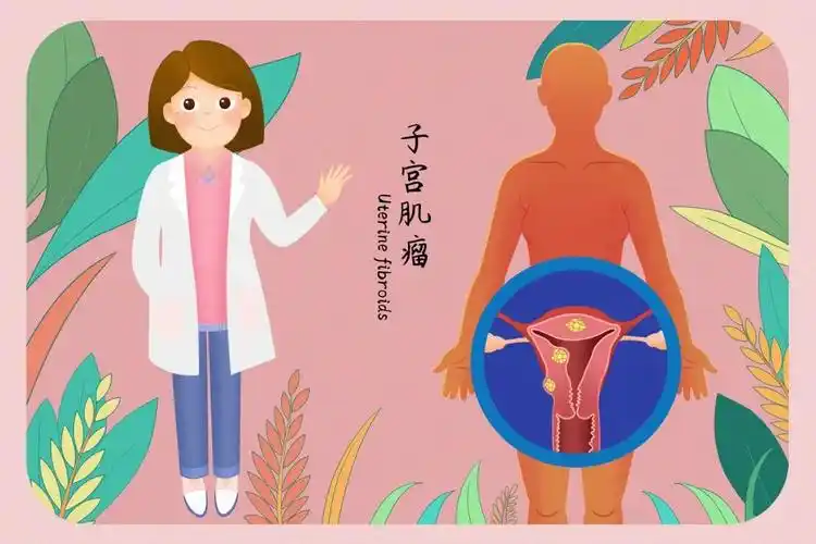 子宮肌瘤最怕三個(gè)運(yùn)動(dòng)是哪三個(gè)動(dòng)作？瑜伽，跳繩都在其中