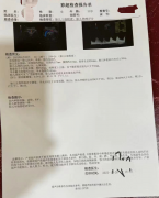 好孕案例 | 一促一移，兒女雙全