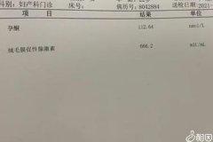 孕吐早晚跟男女有沒有關答案在這，和胎兒性別關系剖析