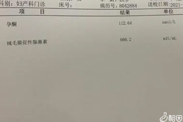 孕激素出現(xiàn)變化會導致孕吐